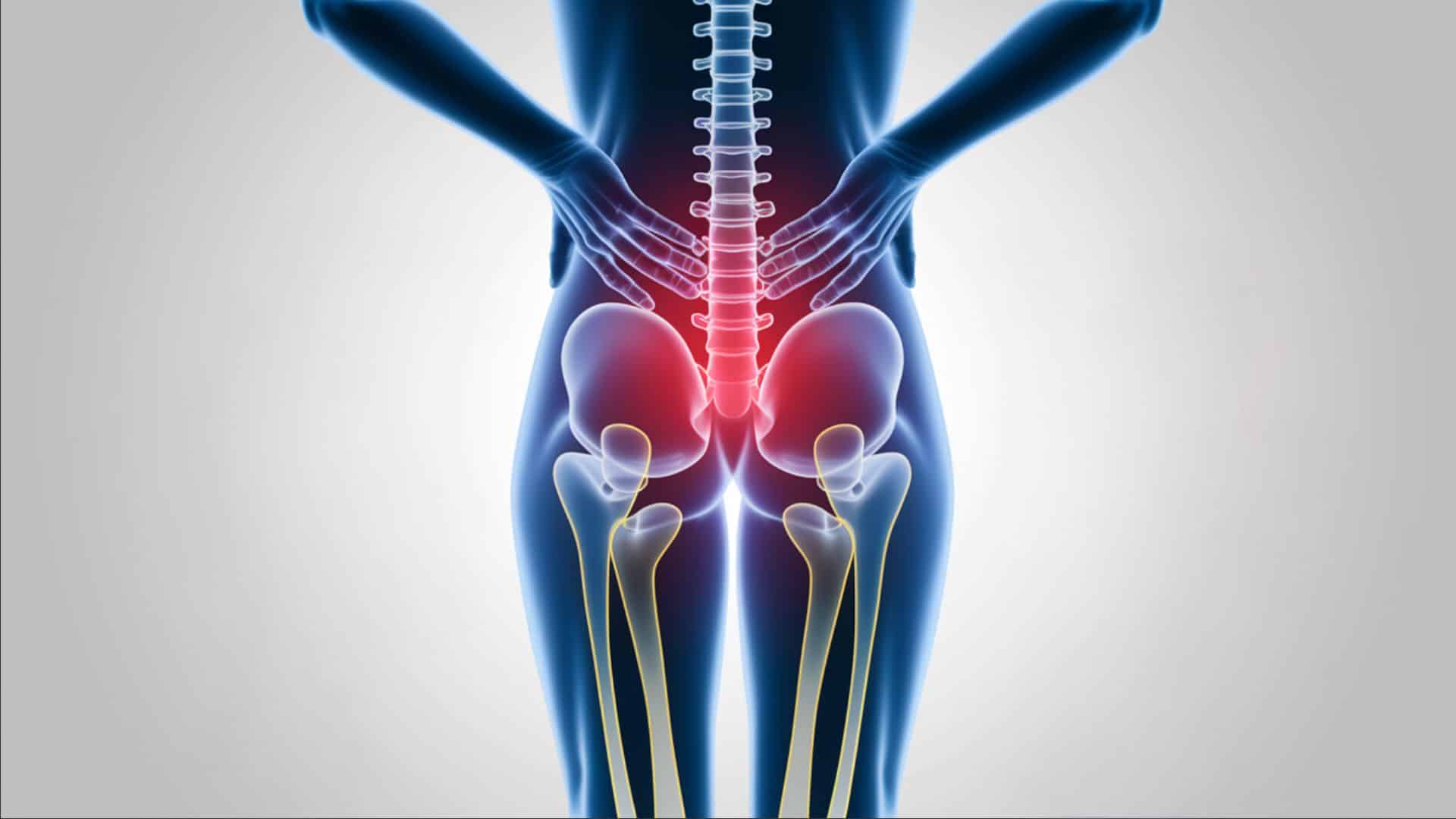 The-Thecal-Sac-Compression-Symptoms