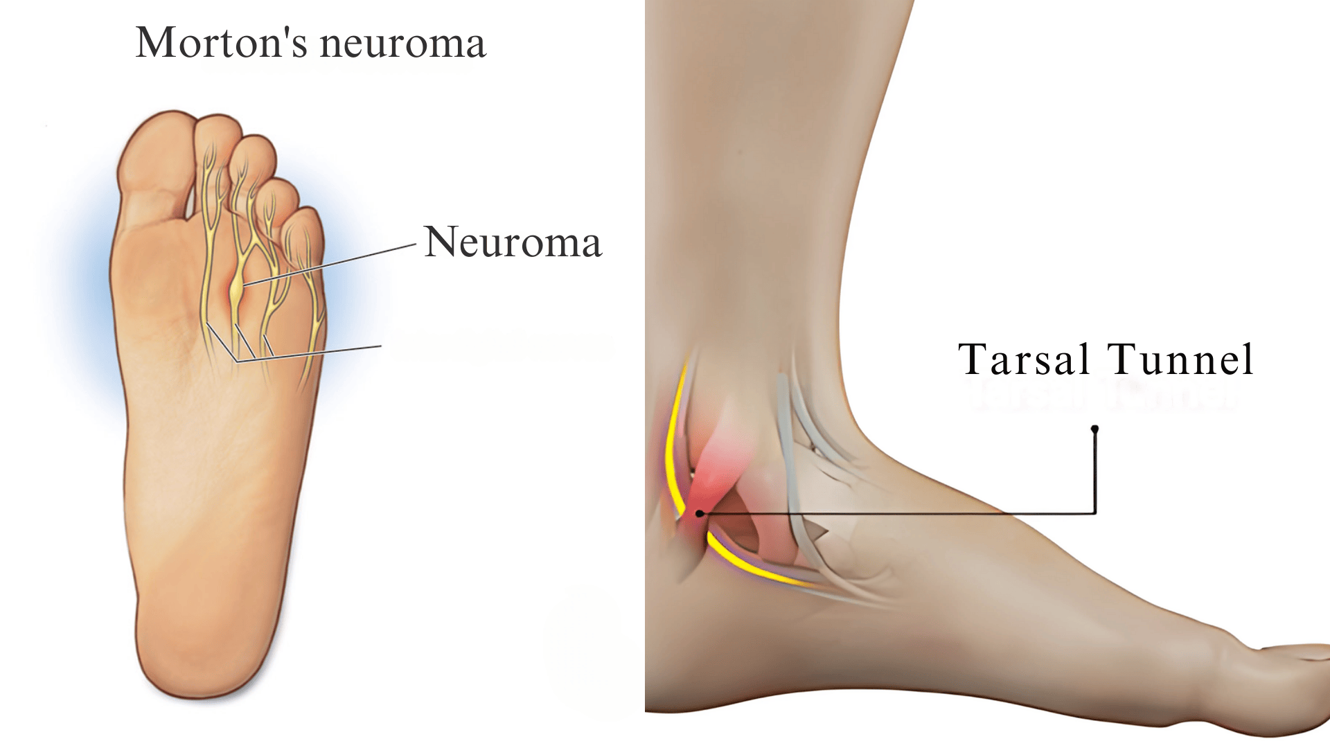 Nerve-Related-Issues