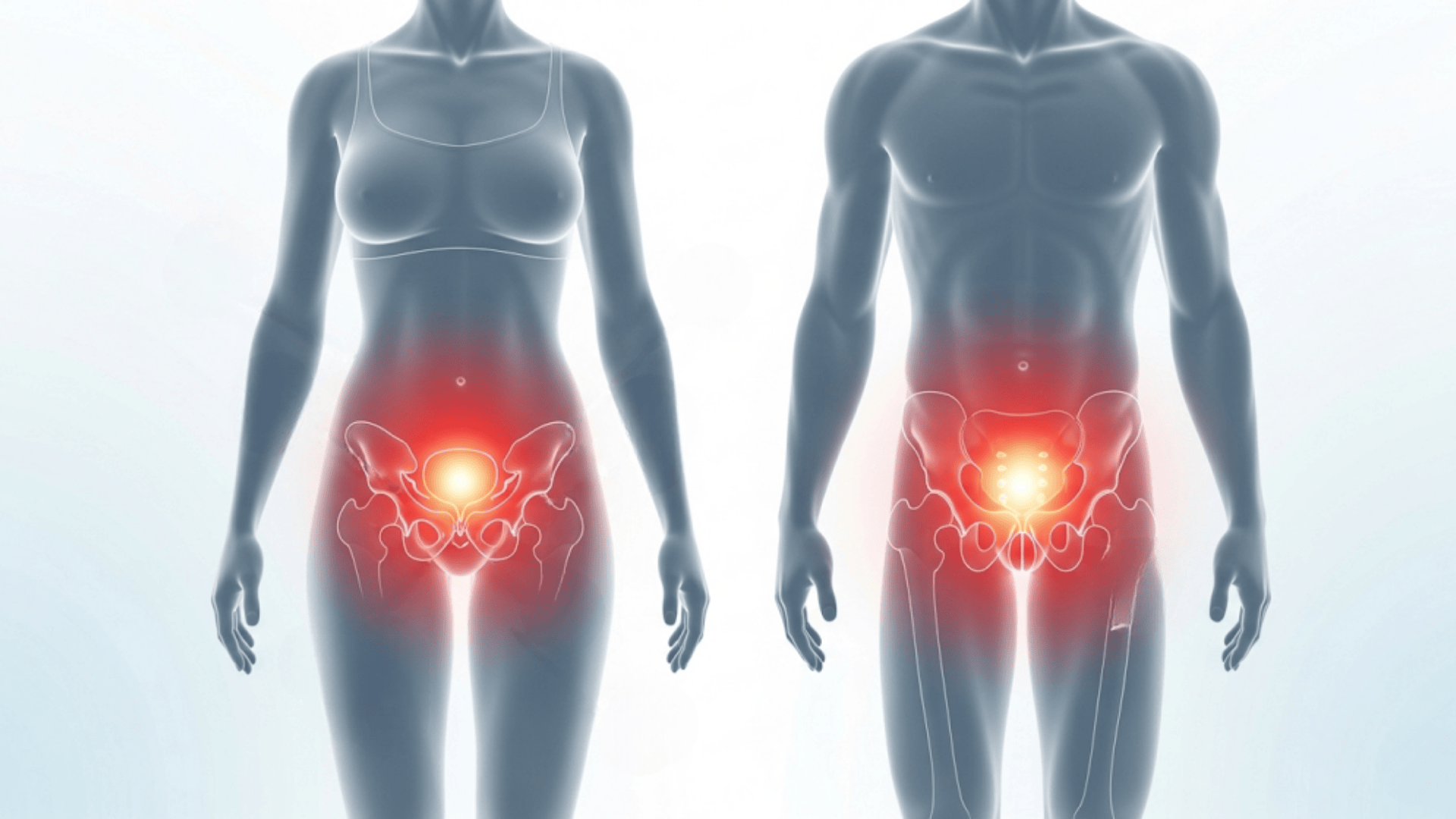 Hypertonic Pelvic Floor: From Symptoms to Treatment