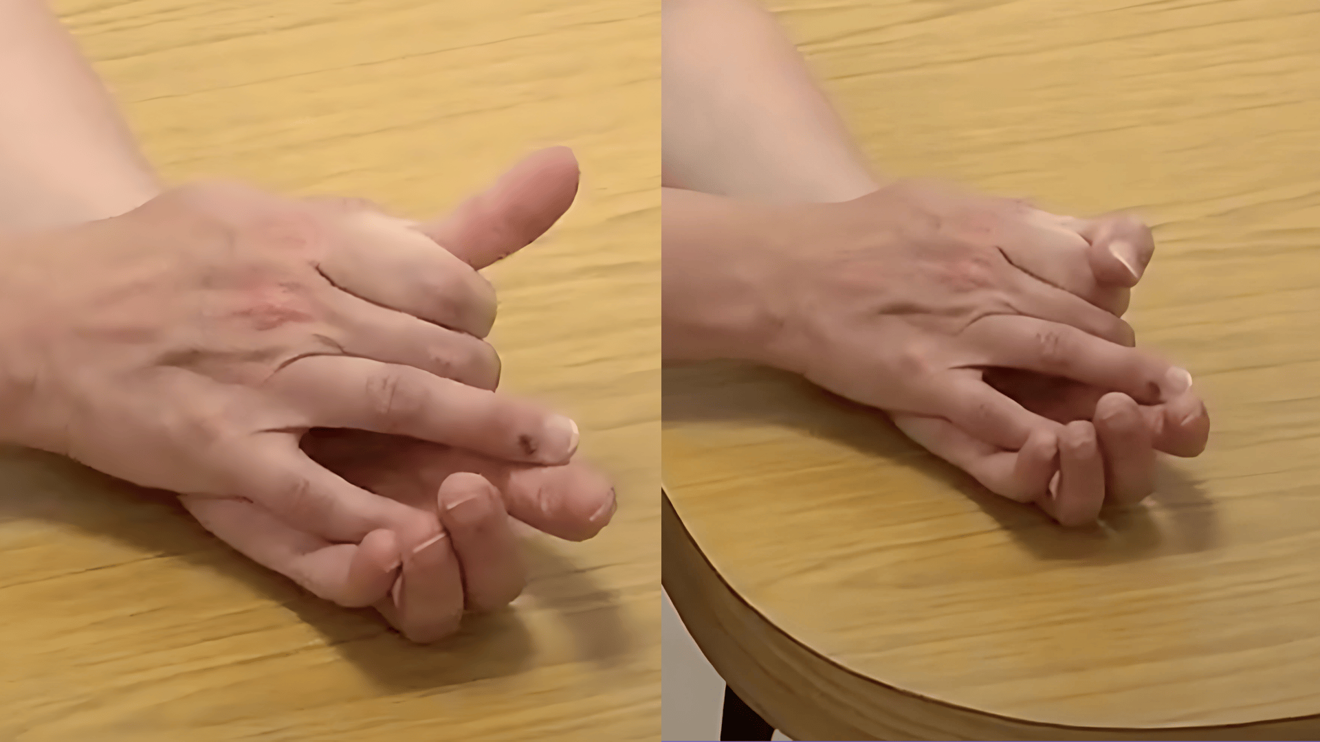 Thumb Bends