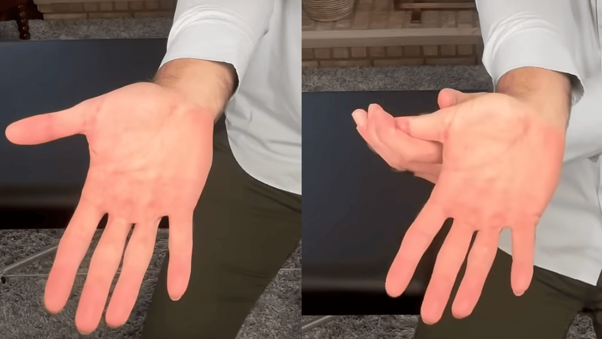 Thumb Web Space Stretch
